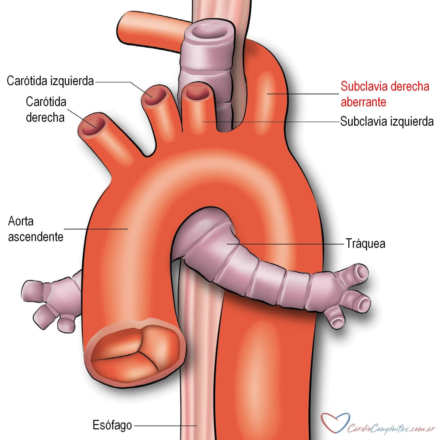 subclavia-der-aberr