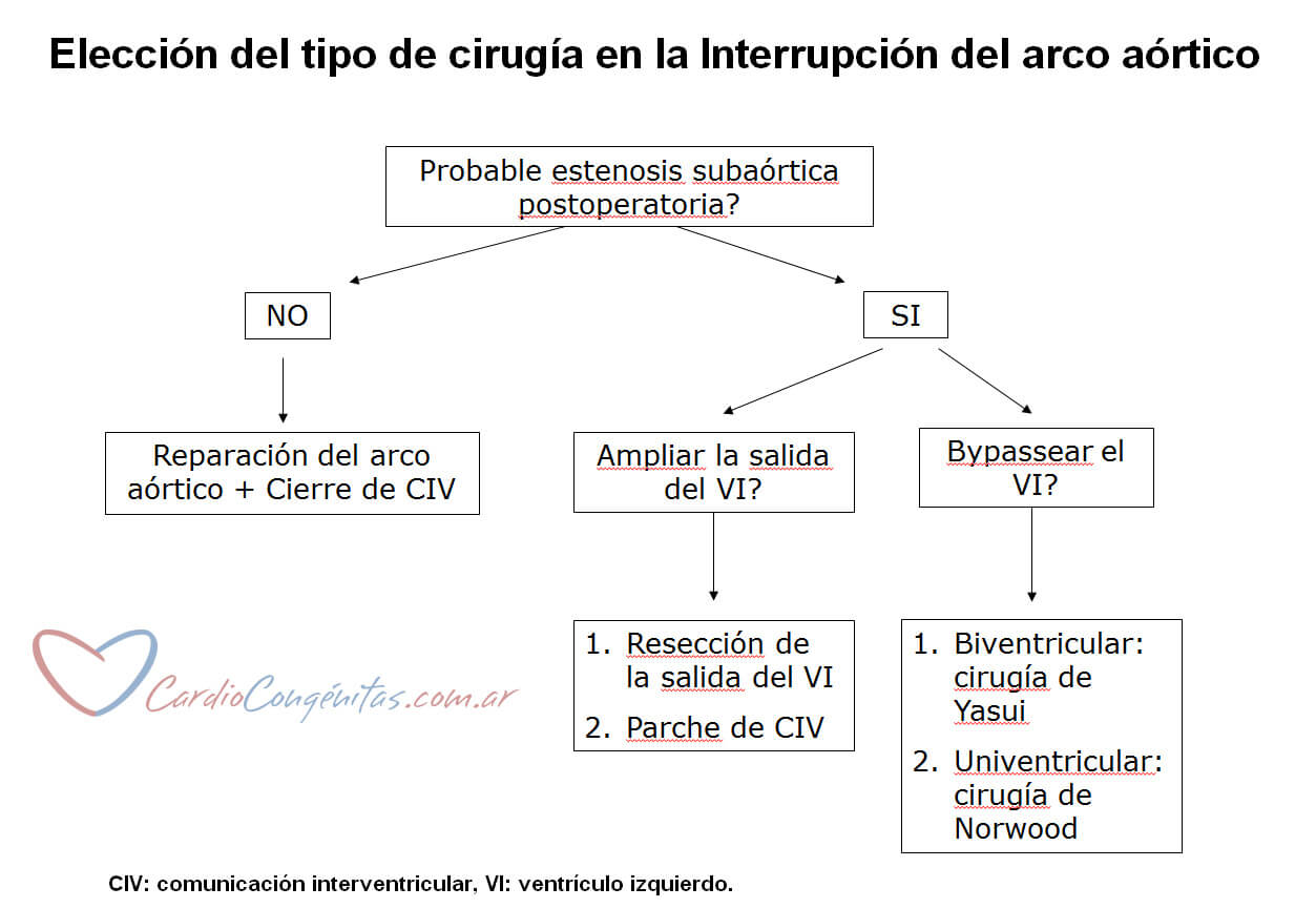Eleccion-de-la-cirugia
