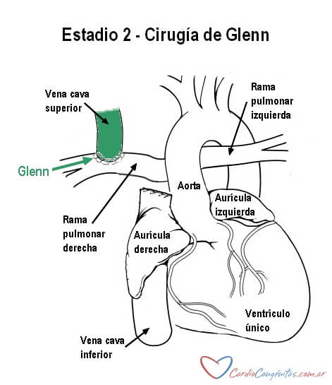 Glenn