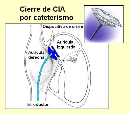 CIA-cierre-por-cat
