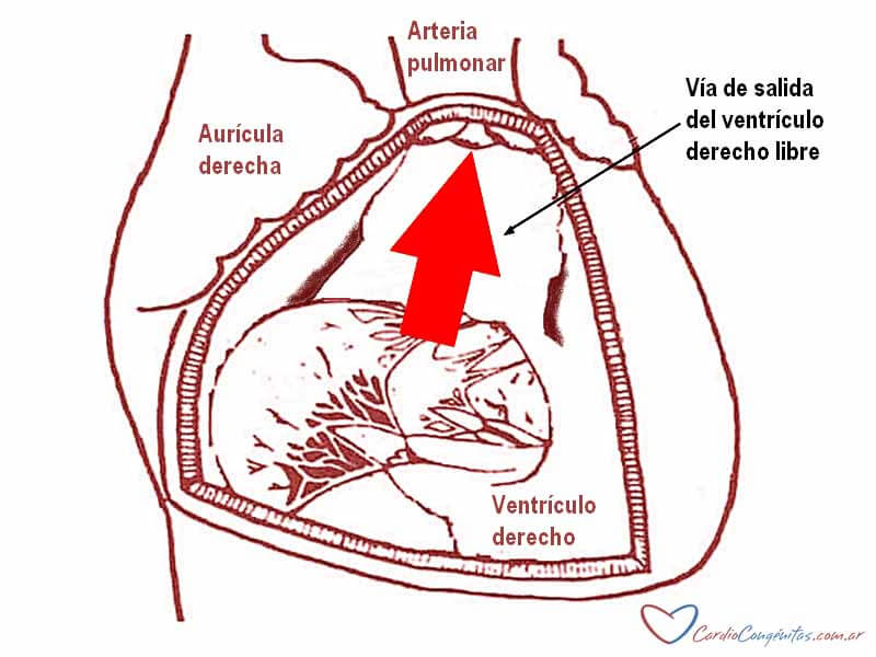 Doble-camara-cirugia