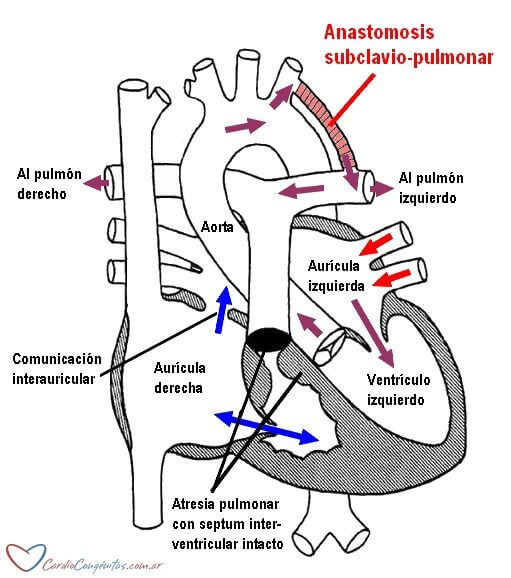 Anastomosis