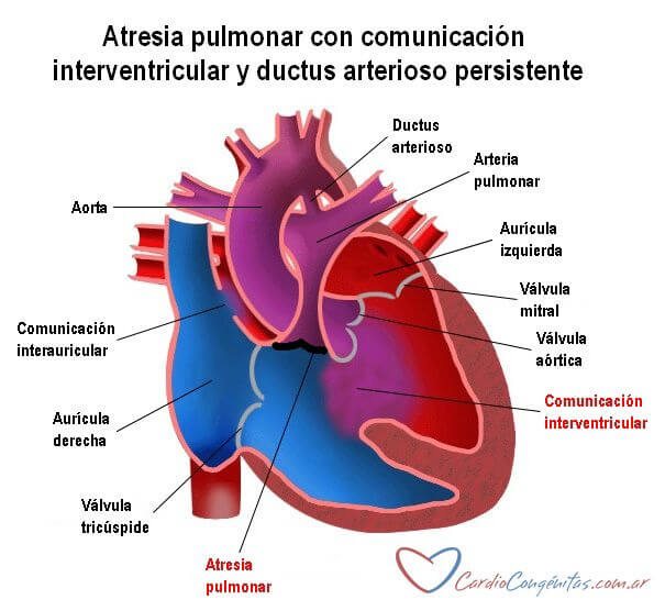 AP-con-CIV-y-DAP-anatomia