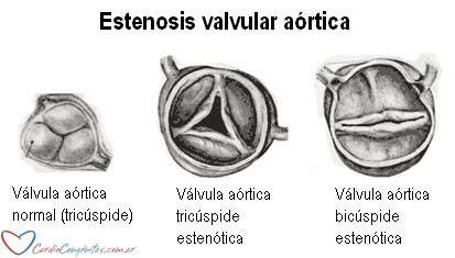EAo-anatomia