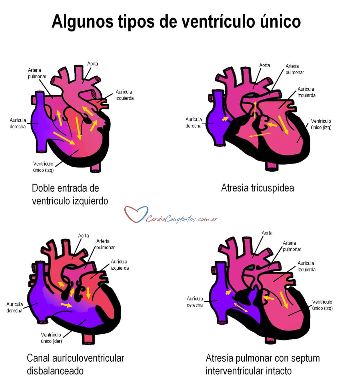 Tipos-de-VU