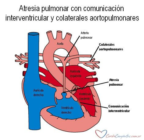 AP-con-CIV-y-colaterales-anatomia