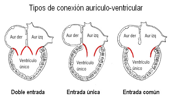 Conexion-AV